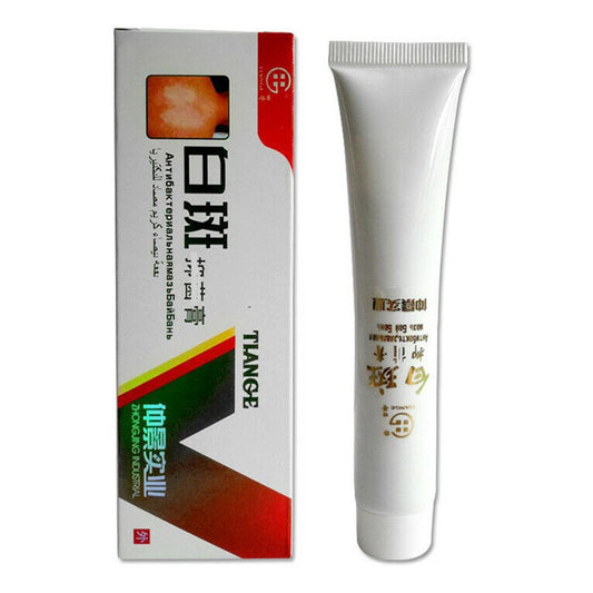 Zhongjing Industrial Tian Ge Brand White Spot Repair Cream 30g White Spot Cream Cream